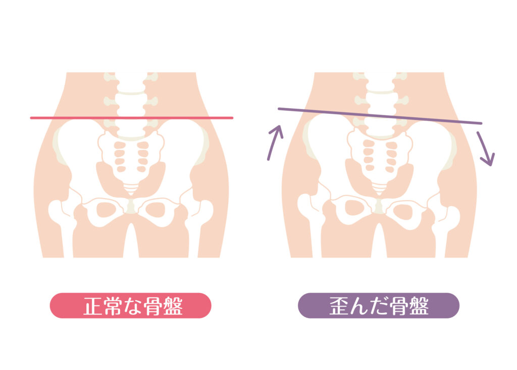意外と知らない、痩せにくい 型とは!? 治療院×Web集客